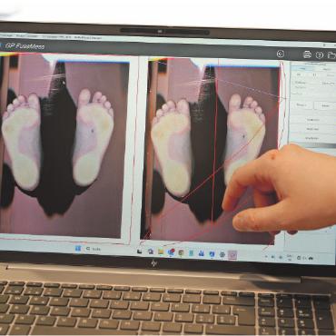 Orthopädische Beratung in Gstaad: damit jeder Schritt leichter fällt - Am Computer wird der digitale Fussabdruck ausgewertet.    FOTOS: JONATHAN SCHOPFER